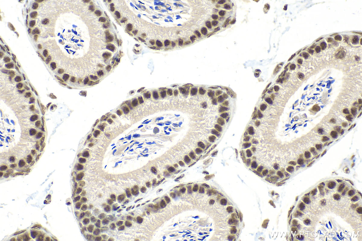 Immunohistochemistry (IHC) staining of mouse testis tissue using QRICH1 Polyclonal antibody (30236-1-AP)