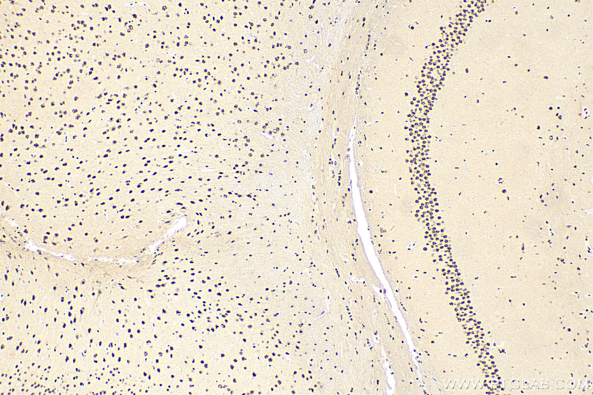 Immunohistochemistry (IHC) staining of mouse brain tissue using QRICH1 Polyclonal antibody (30236-1-AP)