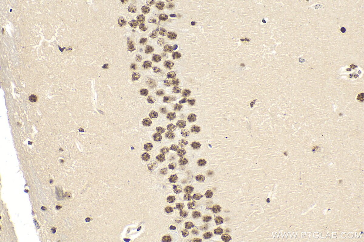 Immunohistochemistry (IHC) staining of mouse brain tissue using QRICH1 Polyclonal antibody (30236-1-AP)