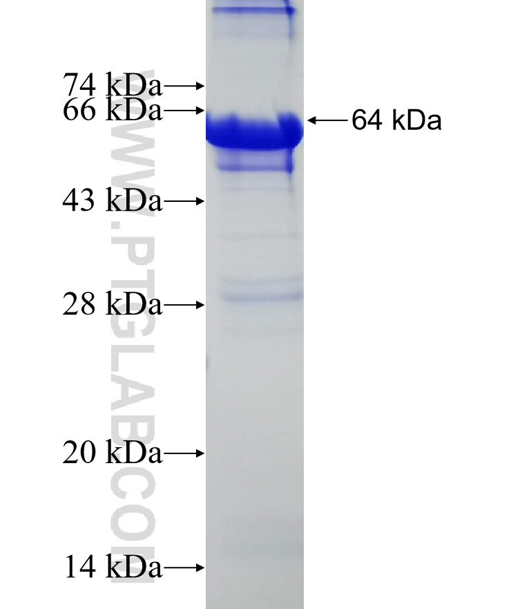 QRICH1 fusion protein Ag31997 SDS-PAGE