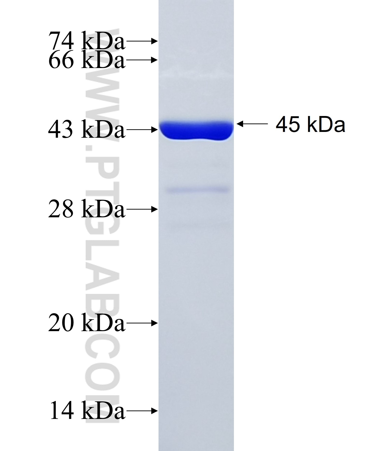 QRICH2 fusion protein Ag35207 SDS-PAGE QRICH2 fusion protein Ag35207 SDS-PAGE