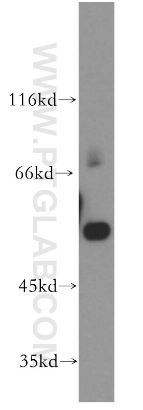 WB analysis of human placenta using 15926-1-AP