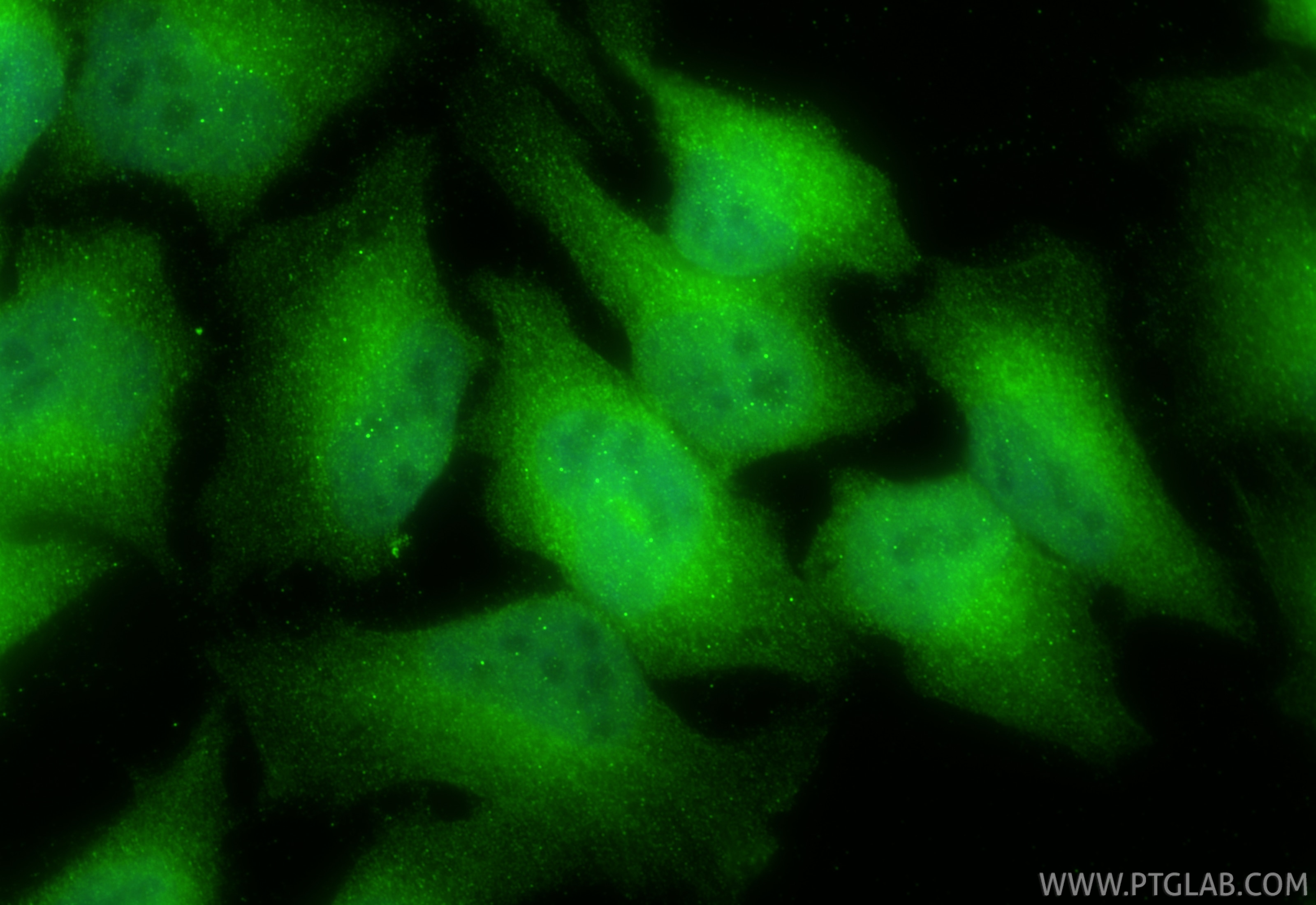 IF Staining of HeLa using 55326-1-AP (same clone as 55326-1-PBS) Immunofluorescence (IF) / fluorescent staining of HeLa cells using QSER1 Polyclonal antibody (55326-1-AP)