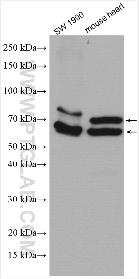 Western Blot (WB) analysis of various lysates using QSOX1 Polyclonal antibody (12713-1-AP)
