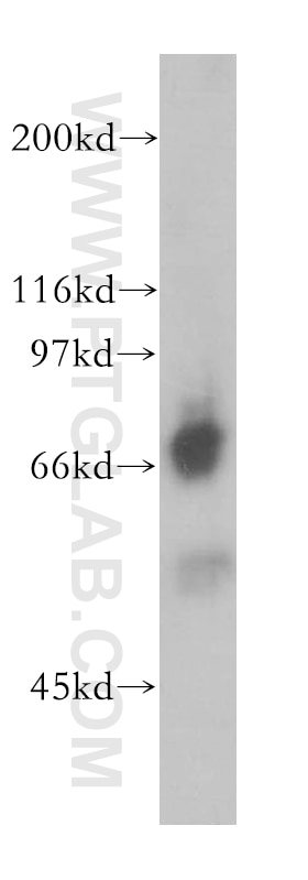 Western Blot (WB) analysis of human placenta tissue using QSOX1 Polyclonal antibody (12713-1-AP)