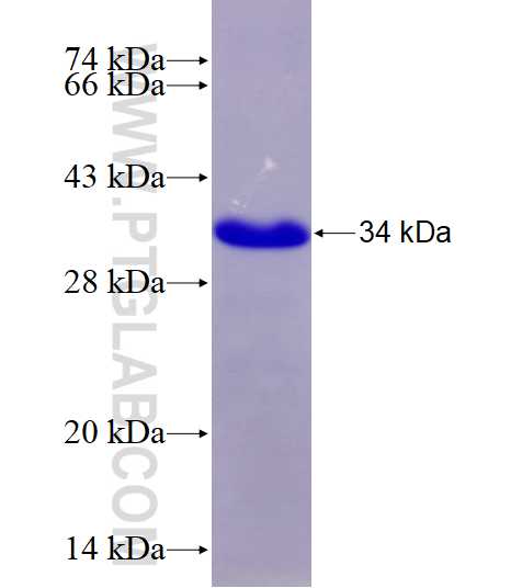 QTRT1 fusion protein Ag3010 SDS-PAGE