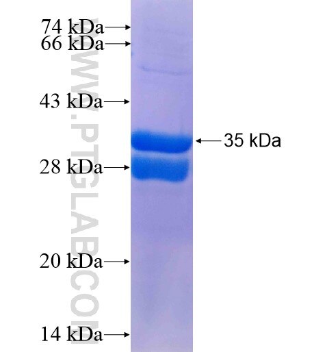 R3HDML fusion protein Ag15668 SDS-PAGE
