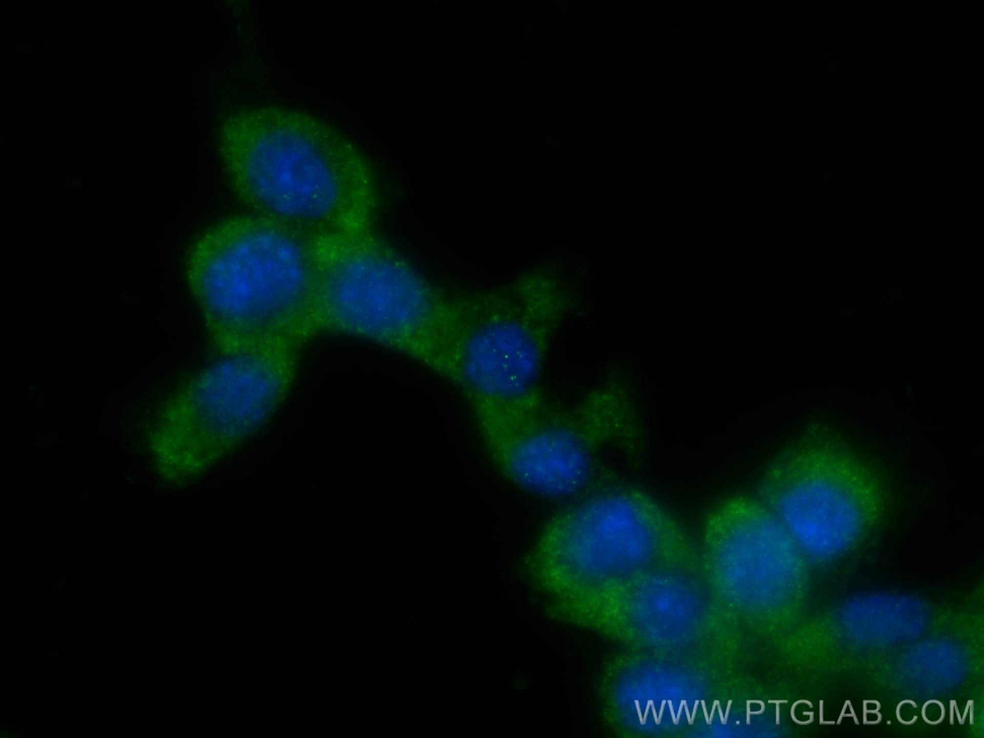Immunofluorescence (IF) / fluorescent staining of NIH/3T3 cells using RAB10 Polyclonal antibody (11808-1-AP)
