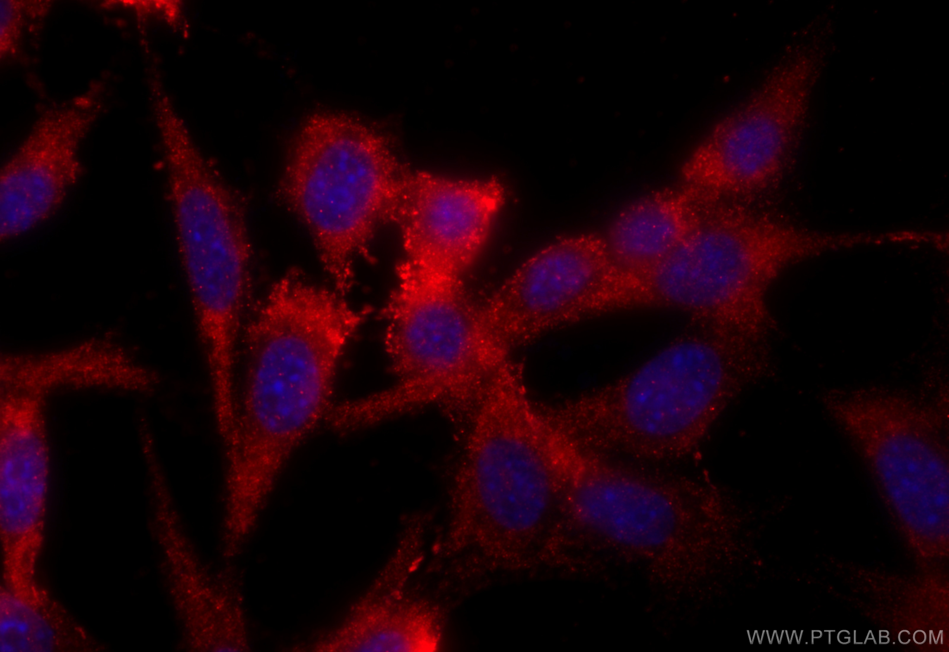 Immunofluorescence (IF) / fluorescent staining of NIH/3T3 cells using RAB10 Polyclonal antibody (11808-1-AP)