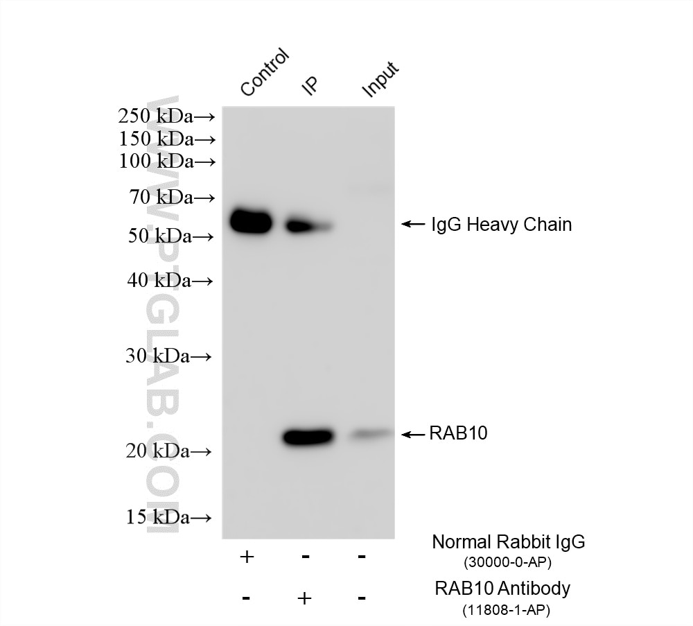 Immunoprecipitation (IP) experiment of mouse brain tissue using RAB10 Polyclonal antibody (11808-1-AP)