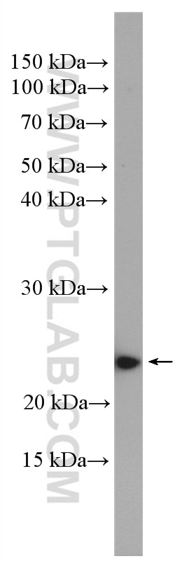 Western Blot (WB) analysis of C6 cells using RAB10 Polyclonal antibody (11808-1-AP)