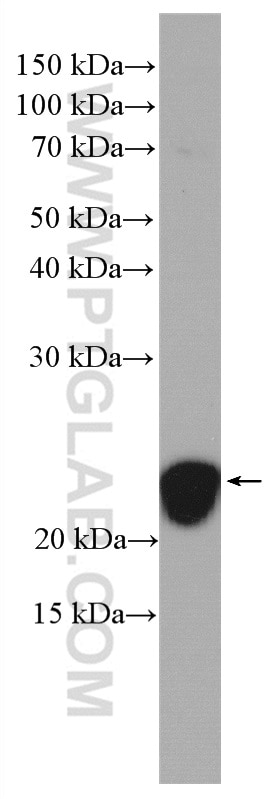 Western Blot (WB) analysis of rat brain tissue using RAB10 Polyclonal antibody (11808-1-AP)