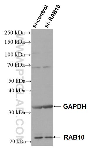 Western Blot (WB) analysis of HeLa cells using RAB10 Polyclonal antibody (11808-1-AP)
