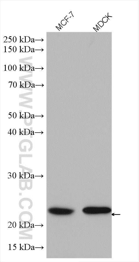 Western Blot (WB) analysis of various lysates using RAB10 Polyclonal antibody (11808-1-AP)