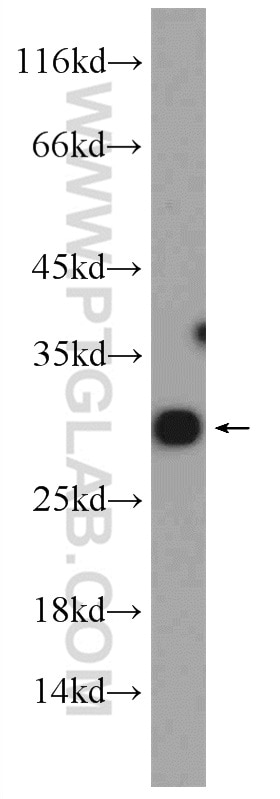 Western Blot (WB) analysis of mouse brain tissue using RAB10 Polyclonal antibody (11808-1-AP)