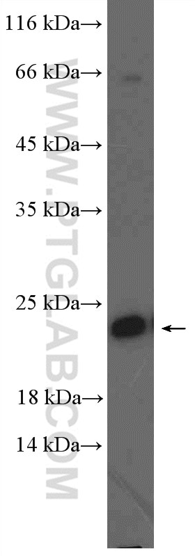 Western Blot (WB) analysis of NIH/3T3 cells using RAB10 Polyclonal antibody (11808-1-AP)