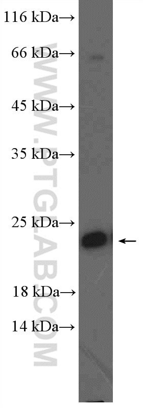 WB analysis of NIH/3T3 using 11808-1-AP