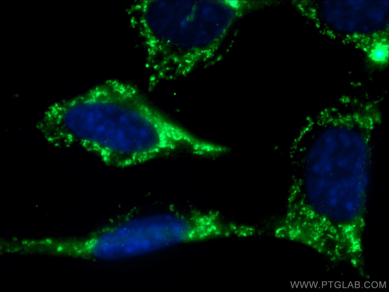 Immunofluorescence (IF) / fluorescent staining of NIH/3T3 cells using RAB10 Polyclonal antibody (27094-1-AP)