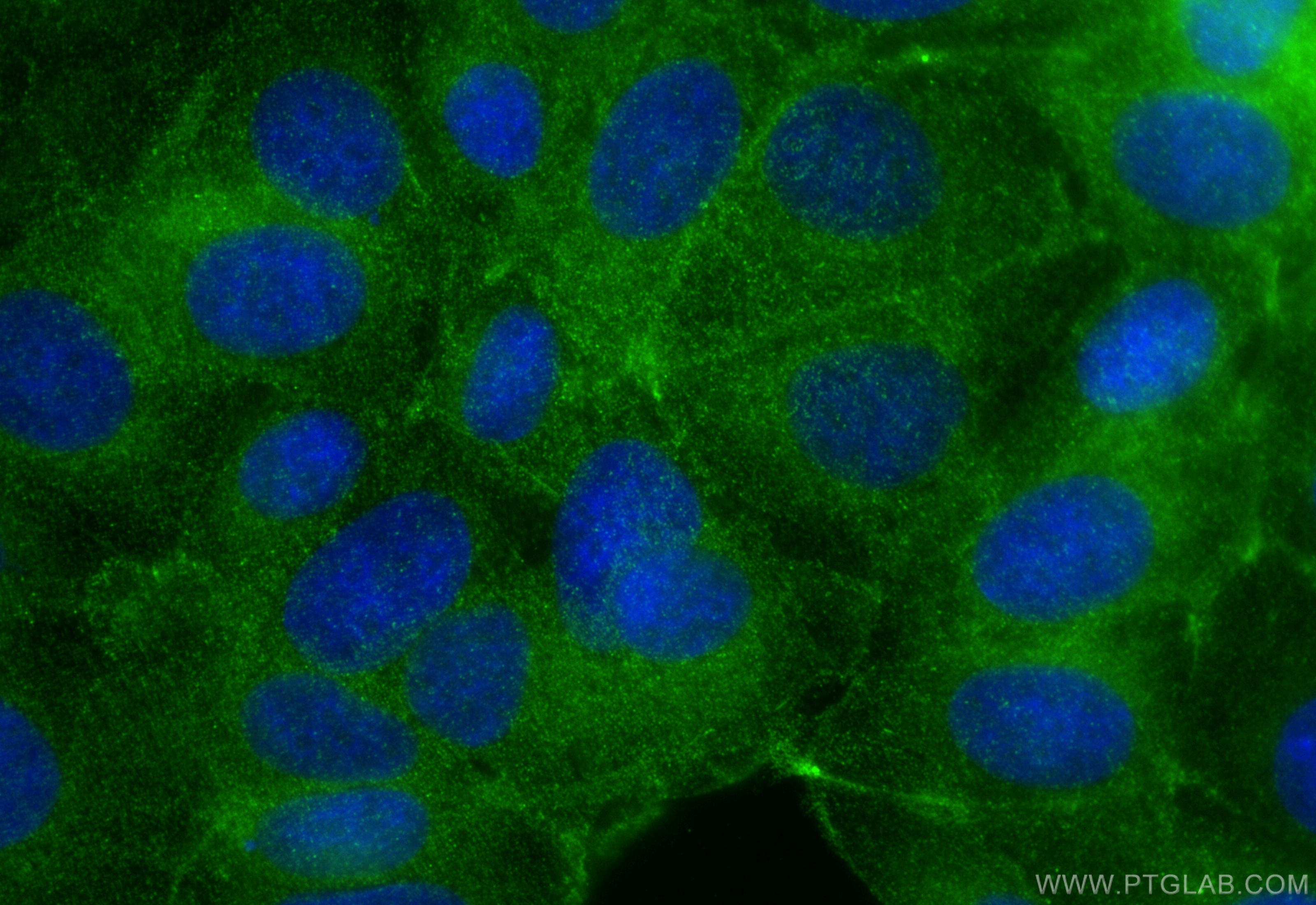 Immunofluorescence (IF) / fluorescent staining of MCF-7 cells using RAB10 Polyclonal antibody (27094-1-AP)