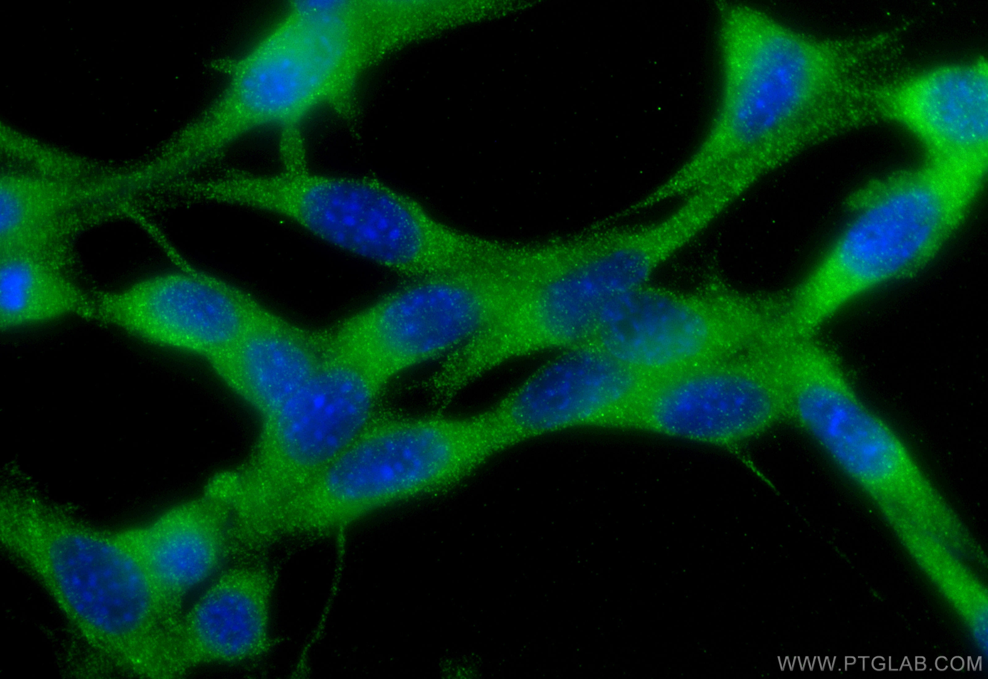 Immunofluorescence (IF) / fluorescent staining of NIH/3T3 cells using RAB10 Polyclonal antibody (27094-1-AP)