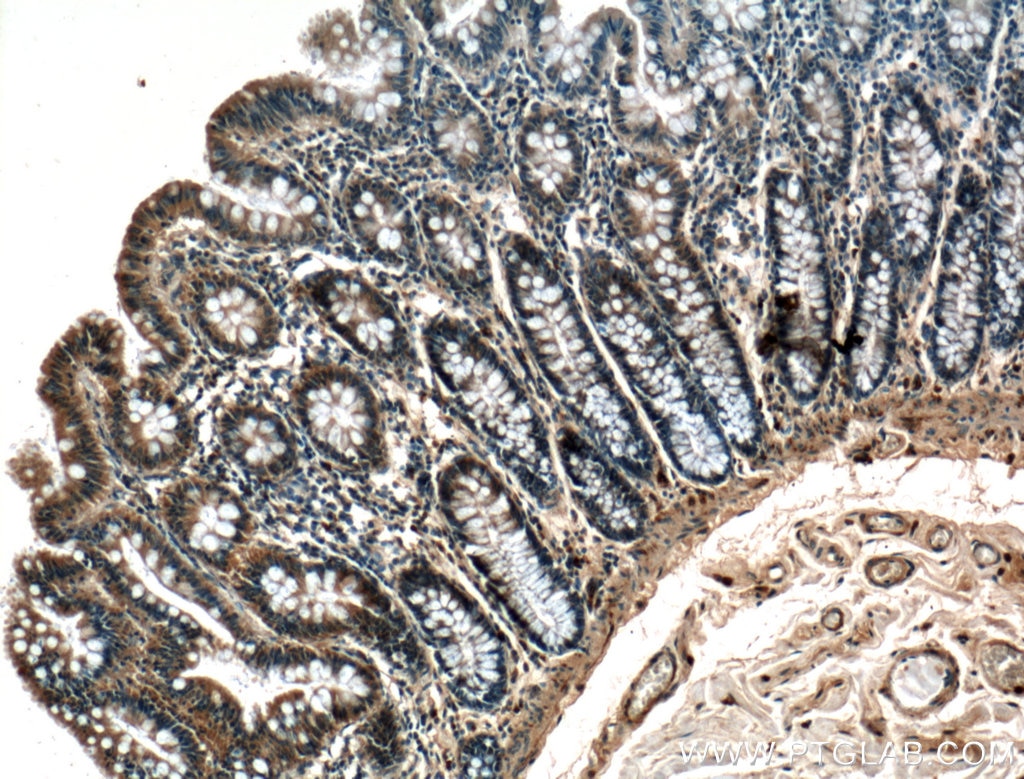 Immunohistochemistry (IHC) staining of human colon tissue using RAB10 Polyclonal antibody (27094-1-AP)