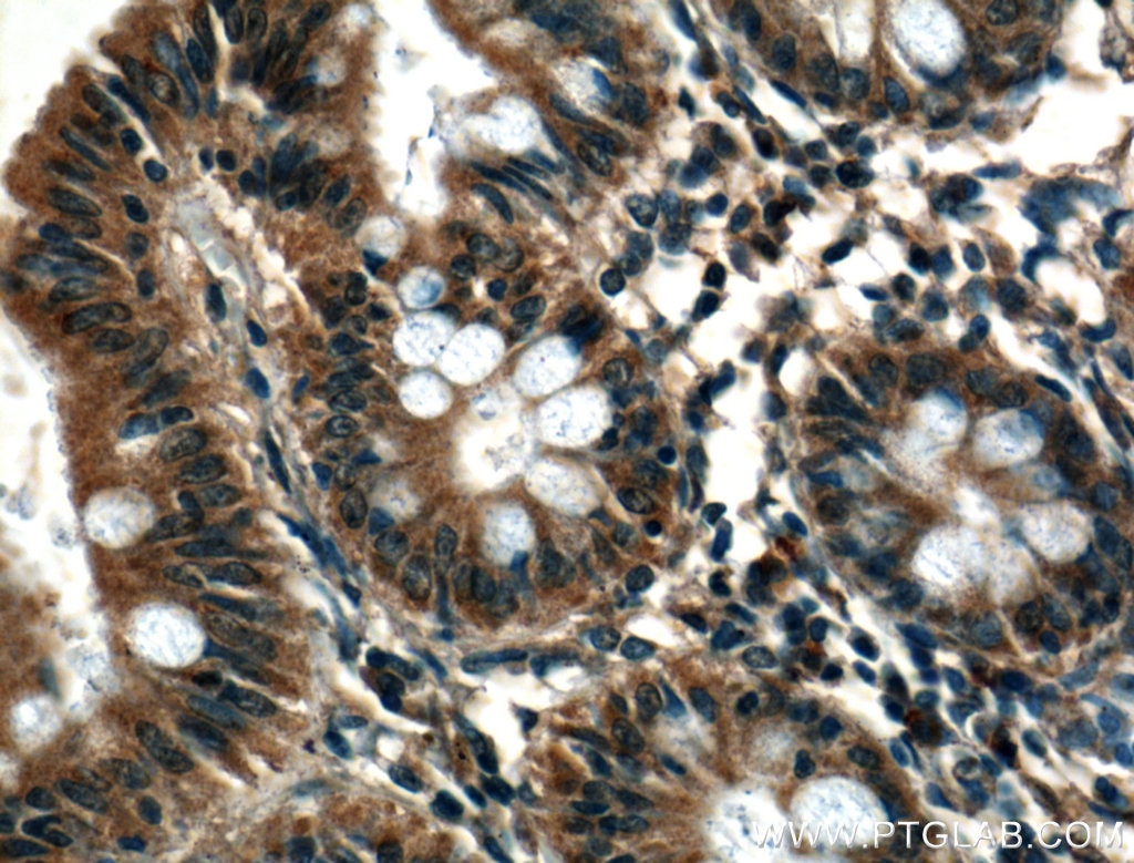 Immunohistochemistry (IHC) staining of human colon tissue using RAB10 Polyclonal antibody (27094-1-AP)