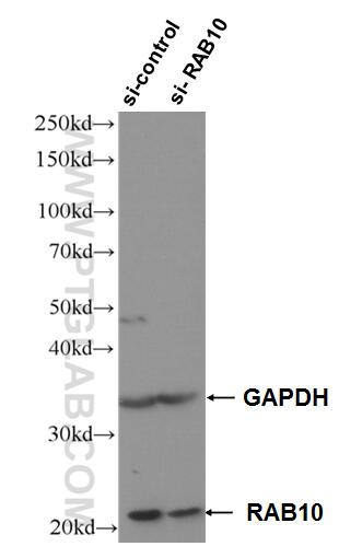 Western Blot (WB) analysis of HeLa cells using RAB10 Polyclonal antibody (27094-1-AP)