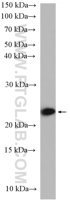 Western Blot (WB) analysis of MDCK cells using RAB10 Polyclonal antibody (27094-1-AP)