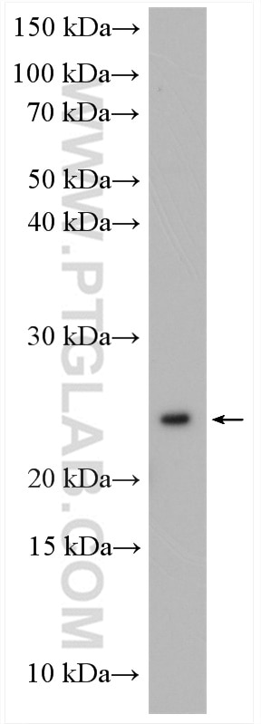 Western Blot (WB) analysis of HeLa cells using RAB10 Polyclonal antibody (27094-1-AP)