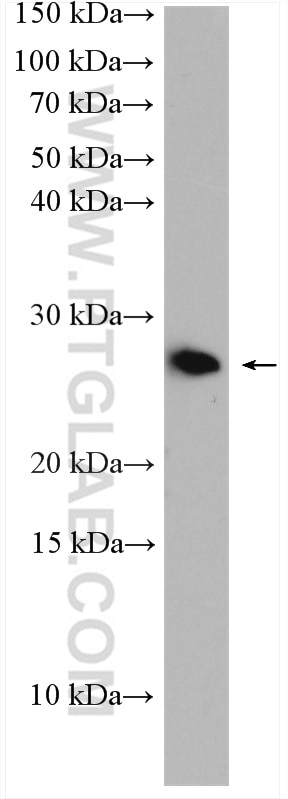Western Blot (WB) analysis of MCF-7 cells using RAB10 Polyclonal antibody (27094-1-AP)