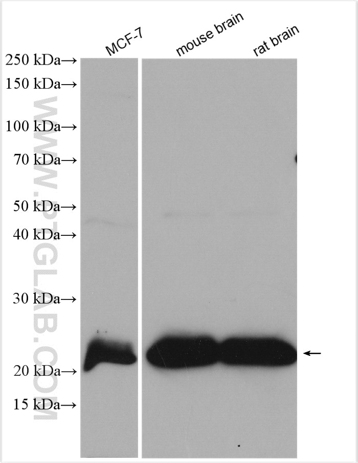 Western Blot (WB) analysis of various lysates using RAB10 Polyclonal antibody (27094-1-AP)