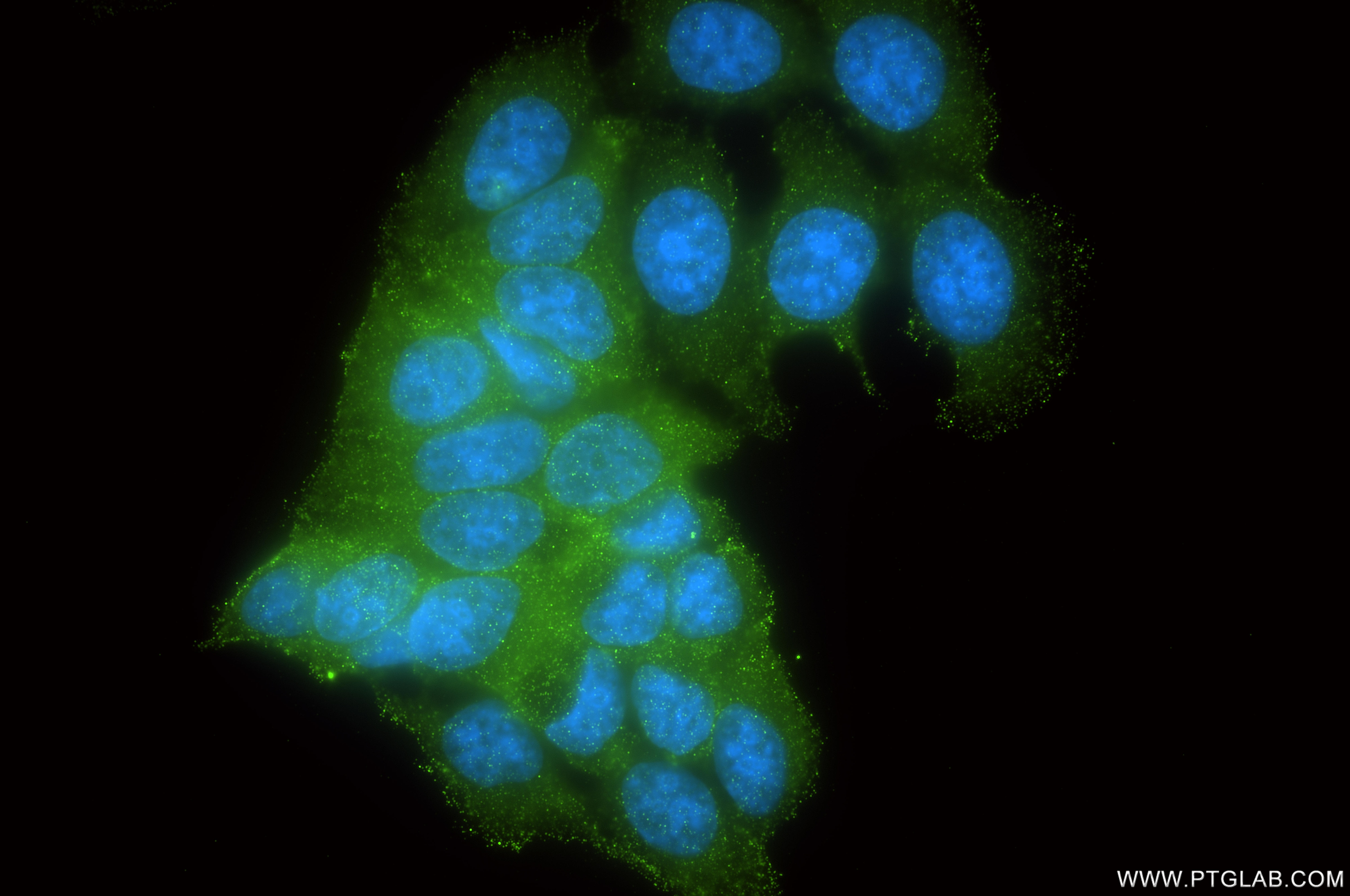 Immunofluorescence (IF) / fluorescent staining of MCF-7 cells using RAB10 Recombinant monoclonal antibody (86787-1-RR)