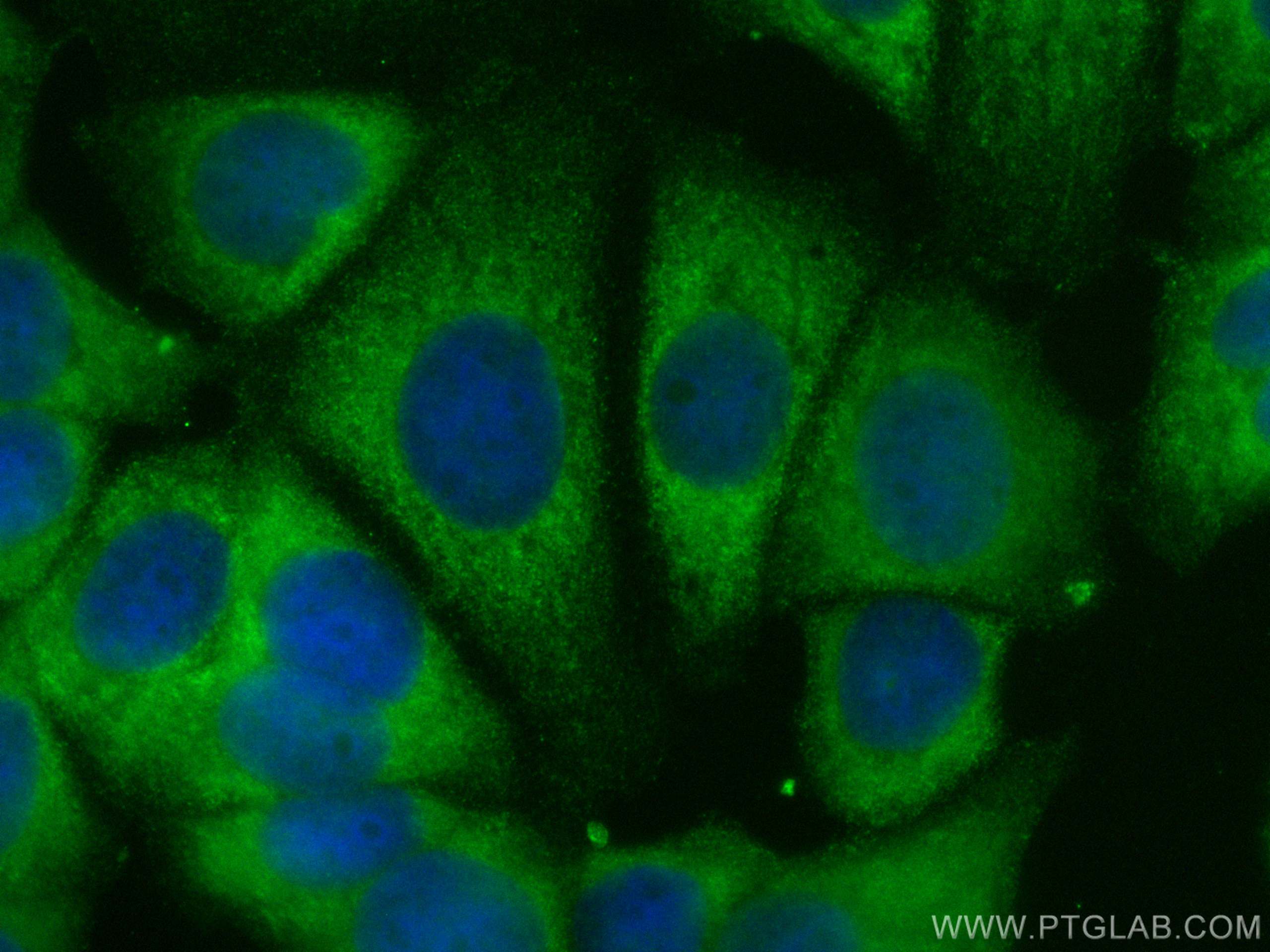 Immunofluorescence (IF) / fluorescent staining of MCF-7 cells using CoraLite® Plus 488-conjugated RAB10 Polyclonal ant (CL488-11808)
