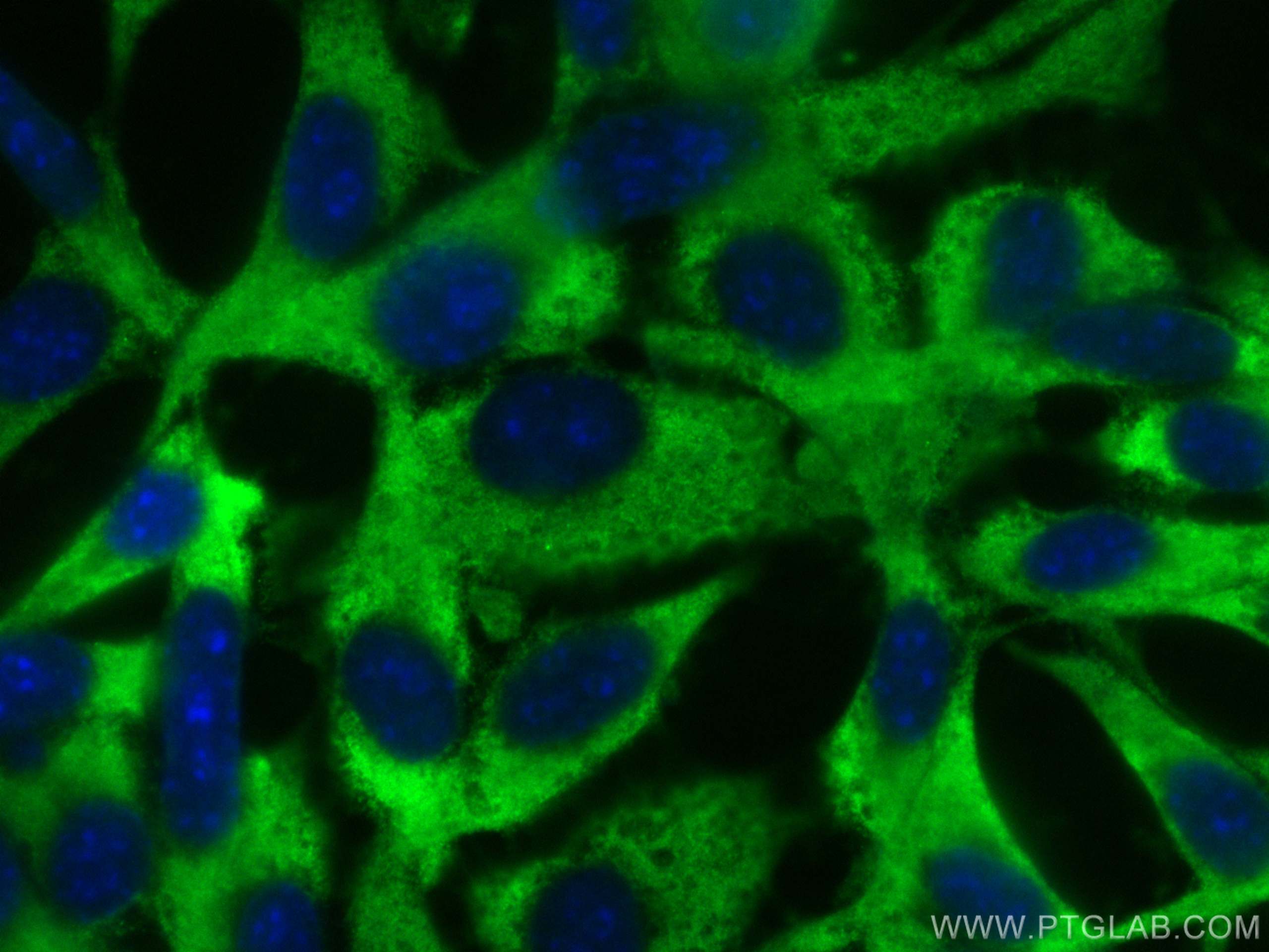 Immunofluorescence (IF) / fluorescent staining of NIH/3T3 cells using CoraLite® Plus 488-conjugated RAB10 Polyclonal ant (CL488-11808)