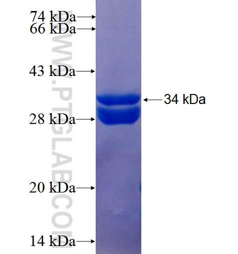 RAB10 fusion protein Ag25830 SDS-PAGE