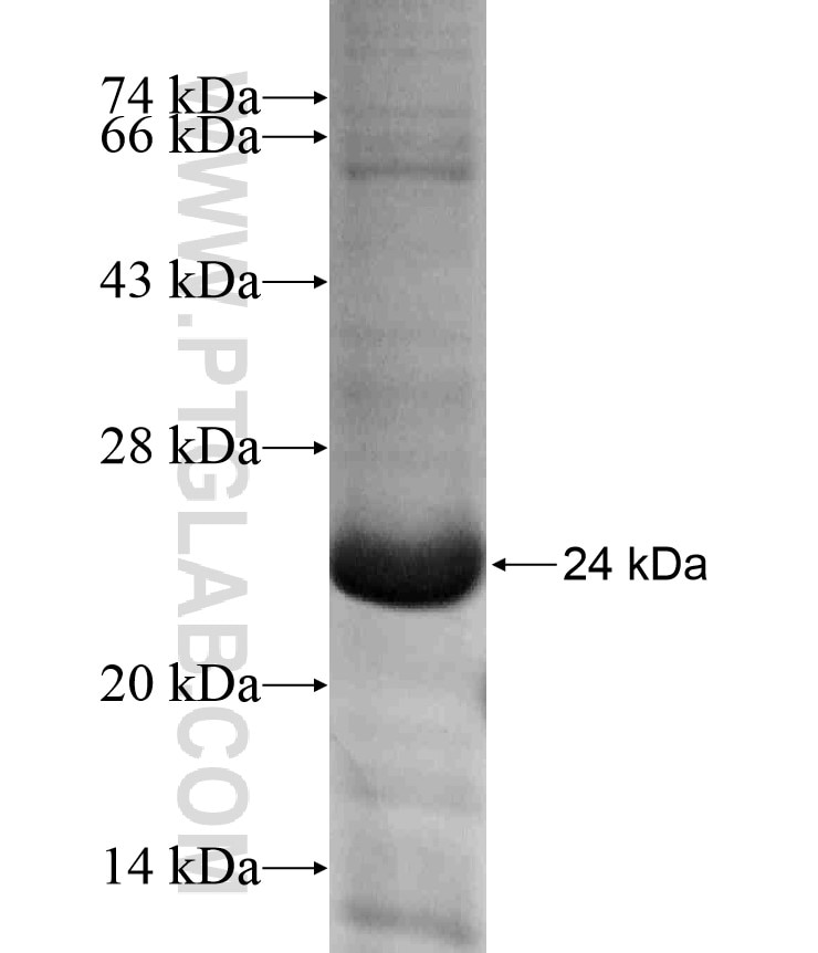 RAB10 fusion protein Ag18098 SDS-PAGE
