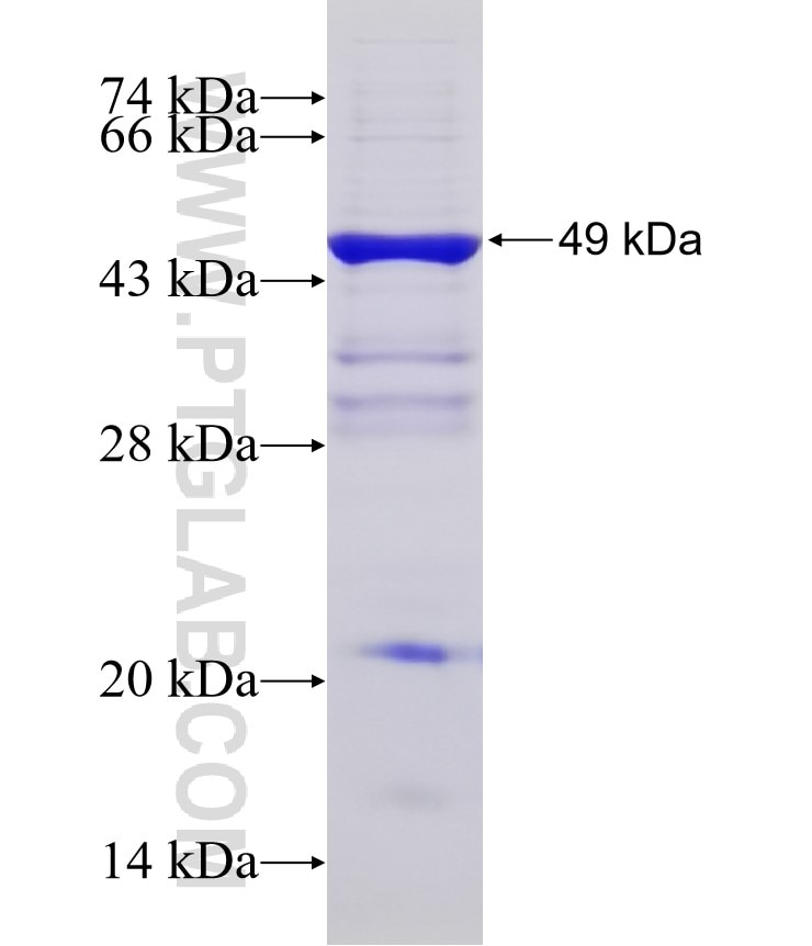 RAB10 fusion protein Ag2473 SDS-PAGE