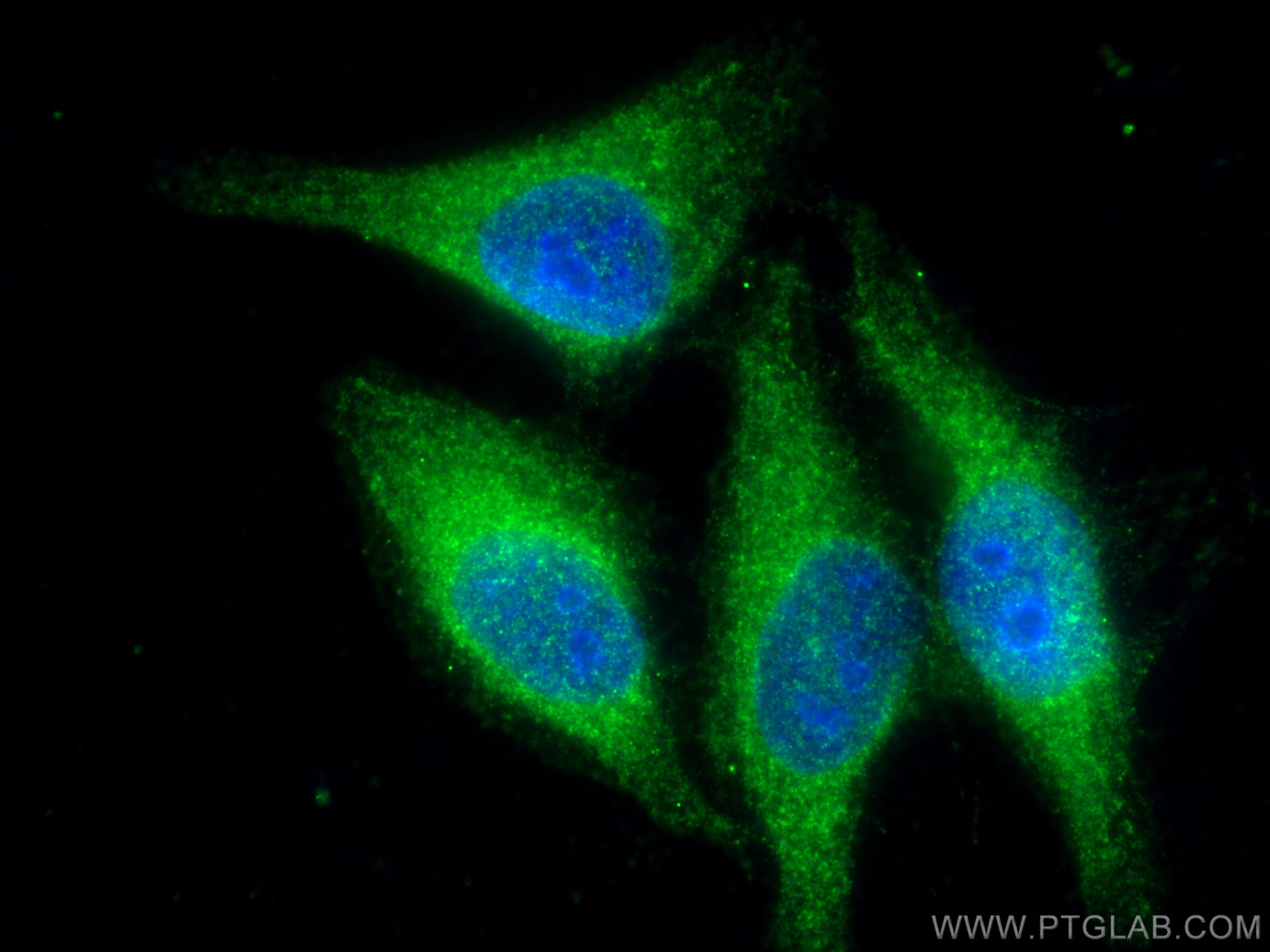 Immunofluorescence (IF) / fluorescent staining of HepG2 cells using RAB11A/B Polyclonal antibody (15903-1-AP)