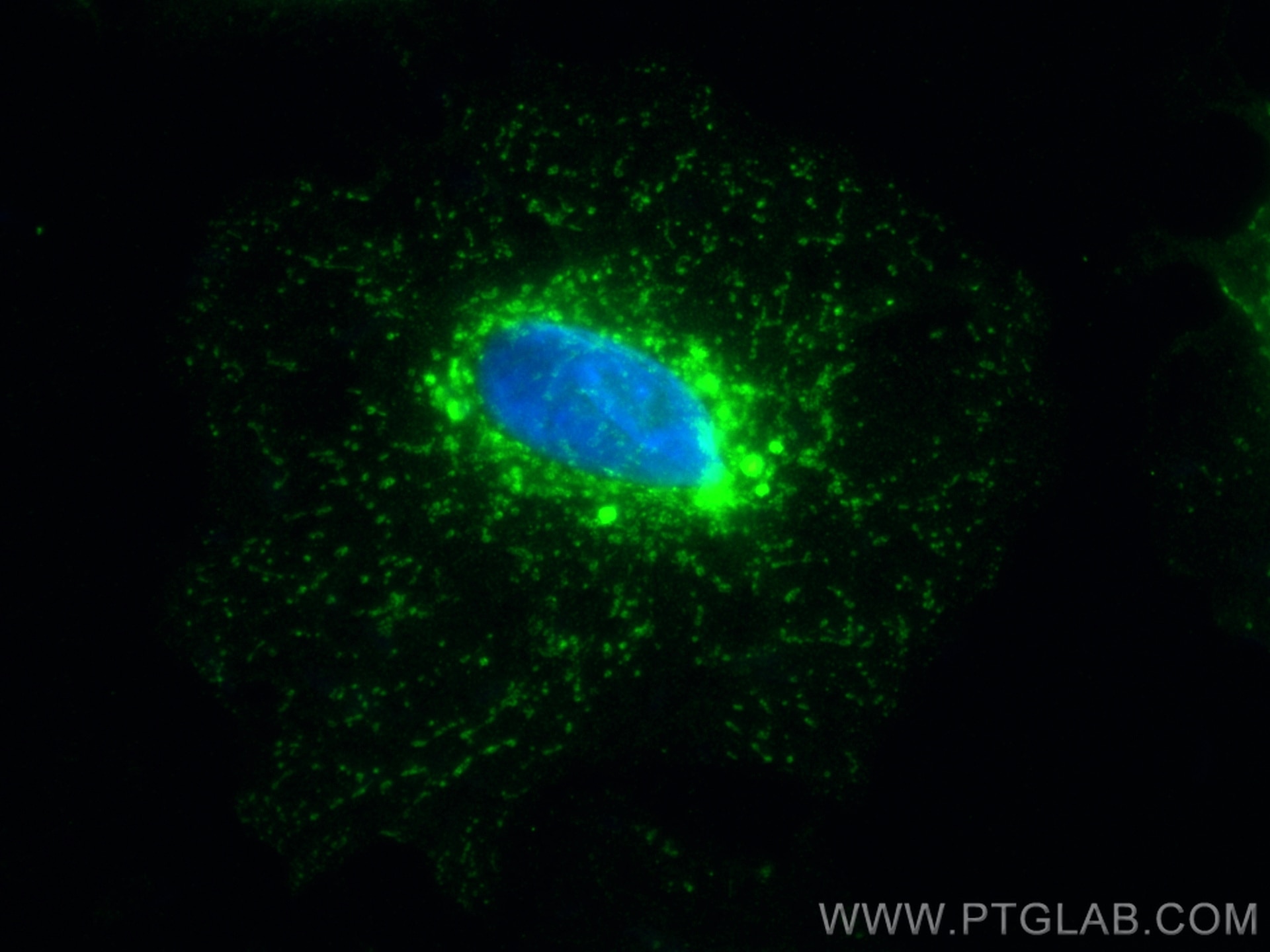 Immunofluorescence (IF) / fluorescent staining of A549 cells using RAB11A/B Polyclonal antibody (15903-1-AP)