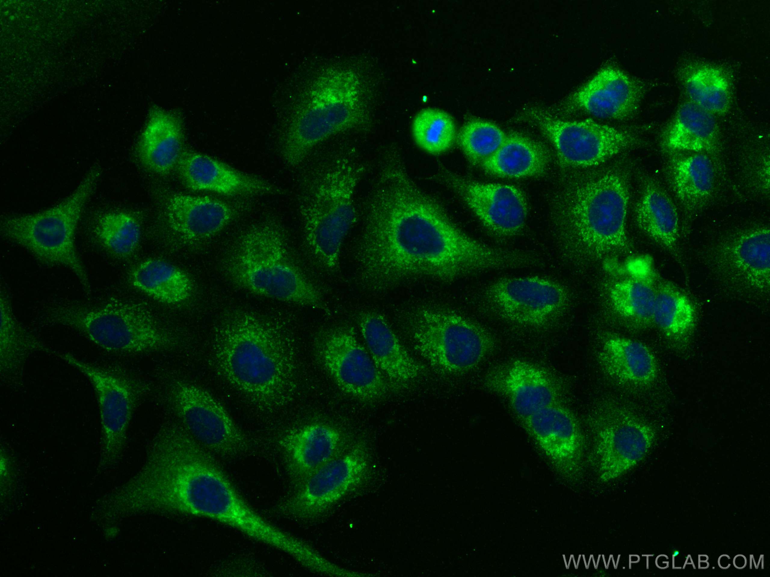 Immunofluorescence (IF) / fluorescent staining of A549 cells using RAB11A/B Polyclonal antibody (15903-1-AP)