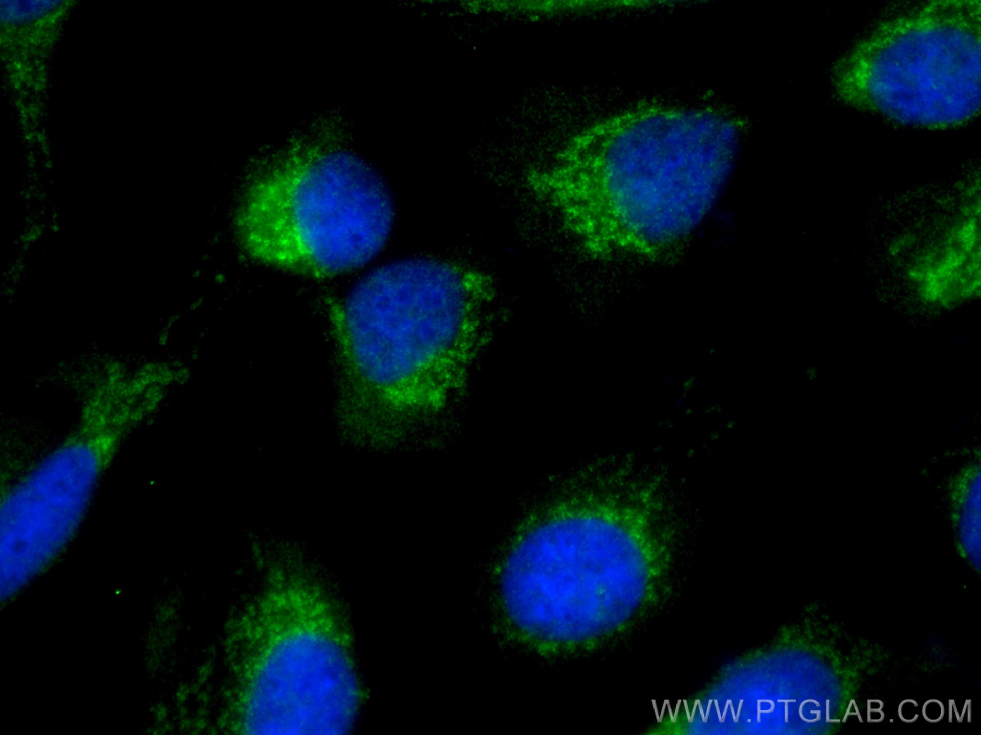 Immunofluorescence (IF) / fluorescent staining of U2OS cells using RAB11A/B Polyclonal antibody (15903-1-AP)