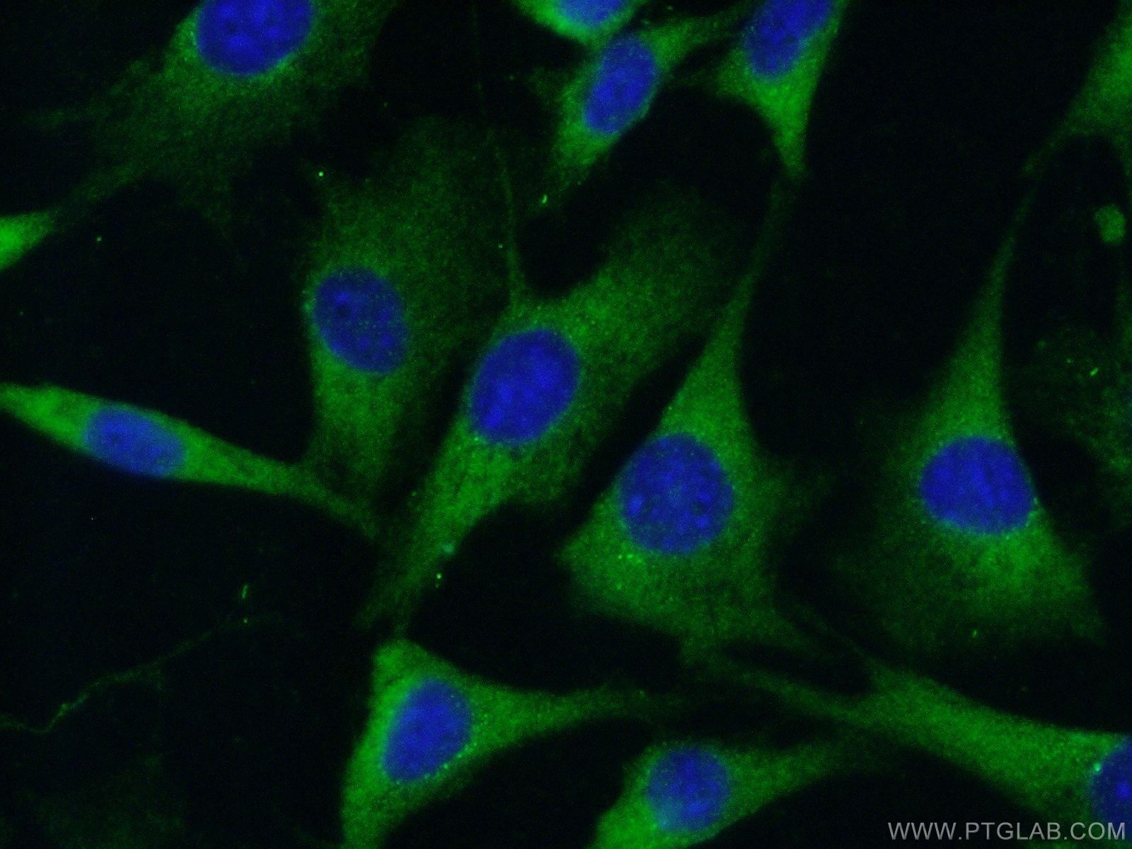 Immunofluorescence (IF) / fluorescent staining of NIH/3T3 cells using RAB11A/B Polyclonal antibody (15903-1-AP)