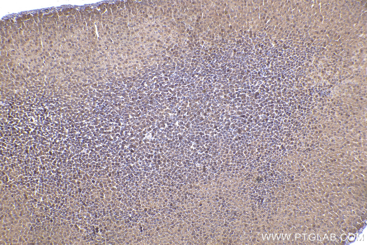 Immunohistochemistry (IHC) staining of mouse adrenal gland tissue using RAB11A/B Polyclonal antibody (15903-1-AP)