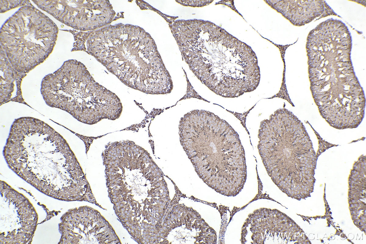 Immunohistochemistry (IHC) staining of rat testis tissue using RAB11A/B Polyclonal antibody (15903-1-AP)