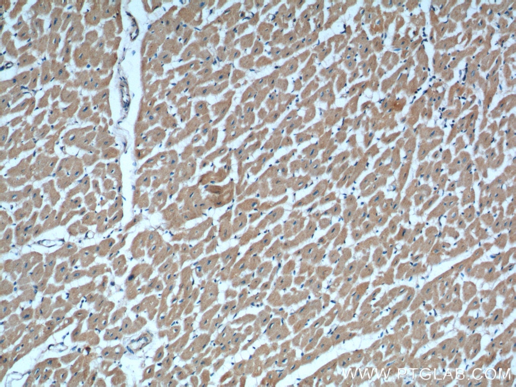 Immunohistochemistry (IHC) staining of human heart tissue using RAB11A/B Polyclonal antibody (15903-1-AP)