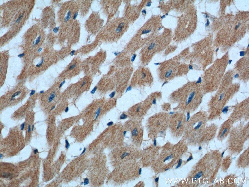 Immunohistochemistry (IHC) staining of human heart tissue using RAB11A/B Polyclonal antibody (15903-1-AP)
