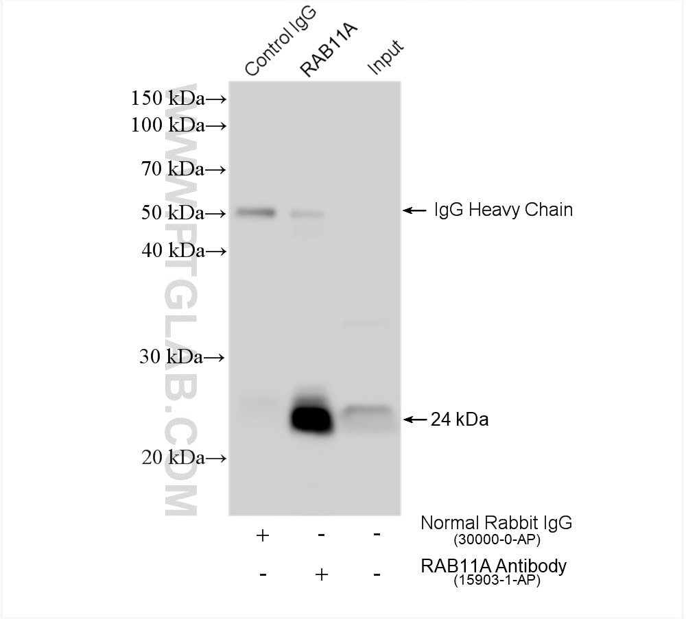 IP experiment of mouse spleen using 15903-1-AP