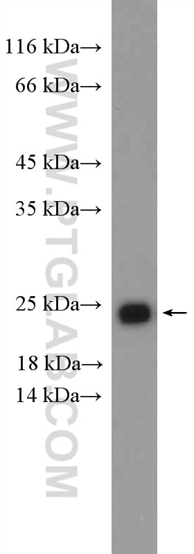 Western Blot (WB) analysis of SH-SY5Y cells using RAB11A/B Polyclonal antibody (15903-1-AP)