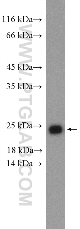 WB analysis of SH-SY5Y using 15903-1-AP