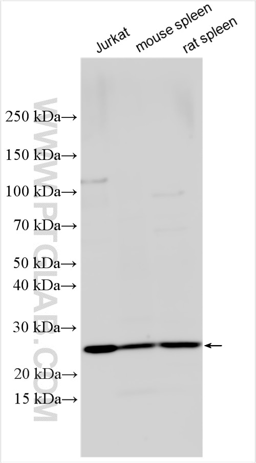 Western Blot (WB) analysis of Jurkat cells using RAB11A/B Polyclonal antibody (15903-1-AP)